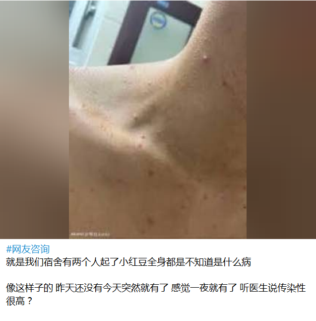 性病艾滋病已经成了东南亚电诈分子最大的生命威胁